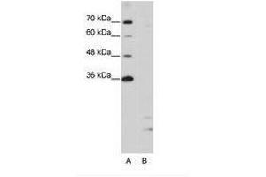 Image no. 1 for anti-Peptidylprolyl Isomerase E (Cyclophilin E) (PPIE) (AA 191-240) antibody (ABIN203035) (PPIE 抗体  (AA 191-240))