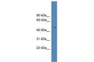 Image no. 1 for anti-serpin Peptidase Inhibitor, Clade A (Alpha-1 Antiproteinase, Antitrypsin), Member 10 (SERPINA10) (AA 101-150) antibody (ABIN6745277)