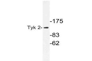 Western blot (WB) analysis of Tyk 2 antibody in extracts from 293cells. (TYK2 抗体)