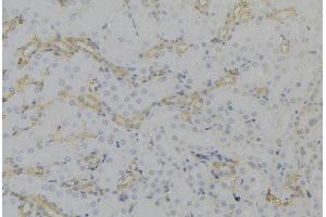 ABIN6279651 at 1/100 staining Mouse kidney tissue by IHC-P. (PEX12 抗体  (Internal Region))