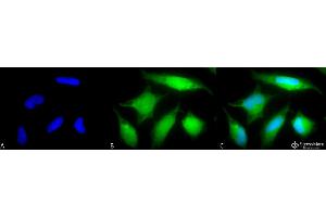 Immunofluorescence (fixed cells) (IF/ICC) image for anti-RAB5A, Member RAS Oncogene Family (RAB5A) antibody (Atto 488) (ABIN2486166)
