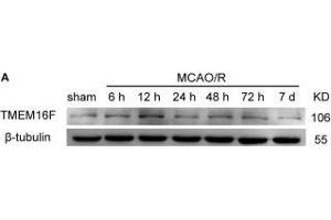 TMEM16F protein level increases after ischemic insult. (Anoctamin 6 抗体  (AA 744-824))