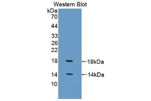 Detection of Recombinant FABP4, Chicken using Polyclonal Antibody to Fatty Acid Binding Protein 4 (FABP4) (FABP4 抗体  (AA 1-125))