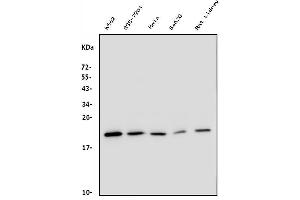 Western blot analysis of DHFR using anti-DHFR antibody (ABIN6719418).
