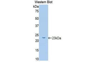 Western Blotting (WB) image for anti-Glucokinase (Hexokinase 4) Regulator (GCKR) (AA 90-286) antibody (ABIN1078068) (GCKR 抗体  (AA 90-286))