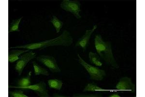 Immunofluorescence of purified MaxPab antibody to PPP6C on HeLa cell. (PPP6C 抗体  (AA 1-305))