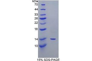 SDS-PAGE (SDS) image for Prostaglandin-Endoperoxide Synthase 2 (Prostaglandin G/H Synthase and Cyclooxygenase) (PTGS2) (AA 240-351) protein (His tag) (ABIN1080576)