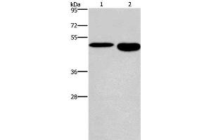 Western Blot analysis of Mouse stomach and brain tissue using DMRT3 Polyclonal Antibody at dilution of 1:550 (DMRT3 抗体)