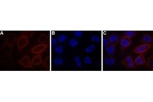 Expression of STIM1 in RBL cells - Cell surface detection of STIM1 in live RBL cells. (STIM1 抗体  (Extracellular) (Atto 550))
