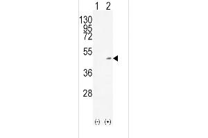 Western blot analysis of ADH1C (arrow) using rabbit polyclonal ADH1C Antibody (Center) (ABIN651725 and ABIN2840376). (ADH1C 抗体  (AA 231-260))