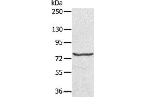 Western blot analysis of Hela cell, using MX1 Polyclonal Antibody at dilution of 1:200 (MX1 抗体)