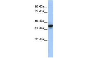 Image no. 1 for anti-Mucin 3B, Cell Surface Associated (MUC3B) (AA 36-85) antibody (ABIN6744267) (MUC3B 抗体  (AA 36-85))