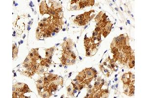Immunohistochemistry analysis of paraffin-embedded human stomach using IL22RA1 Polyclonal Antibody at dilution of 1:200. (IL22 Receptor alpha 1 抗体)