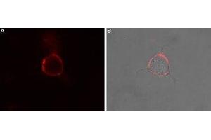 Immunocytochemistry (ICC) image for anti-Tachykinin Receptor 1 (TACR1) (AA 180-194), (Extracellular) antibody (ABIN7043803)