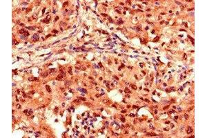 Immunohistochemistry (IHC) image for anti-Proteasome (Prosome, Macropain) 26S Subunit, Non-ATPase, 2 (PSMD2) (AA 401-700), (Regulatory Subunit 2) antibody (ABIN7142208)