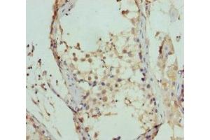Immunohistochemistry of paraffin-embedded human testis tissue using ABIN7152449 at dilution of 1:100 (FBXO7 抗体  (AA 353-522))
