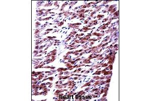 RM33 Antibody (C-term) ((ABIN657799 and ABIN2846772))immunohistochemistry analysis in formalin fixed and paraffin embedded human heart tissue followed by peroxidase conjugation of the secondary antibody and DAB staining.