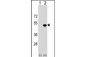 Western blot analysis of KRR1 (arrow) using rabbit polyclonal KRR1 Antibody (N-term) (ABIN1538757 and ABIN2848753). (KRR1 抗体  (N-Term))