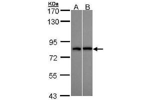 Western Blotting (WB) image for anti-DEAD (Asp-Glu-Ala-Asp) Box Polypeptide 3, X-Linked (DDX3X) (Center) antibody (ABIN2856700)