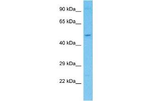 Host:  Rabbit  Target Name:  KCTD20  Sample Type:  Hela Whole Cell lysates  Antibody Dilution:  1. (KCTD20 抗体  (C-Term))