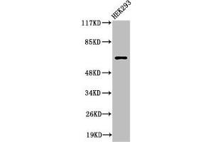 Western Blot analysis of 293 cells using Cleaved-ITI-H2 (D702) Polyclonal Antibody (ITIH2 抗体  (Cleaved-Asp702))
