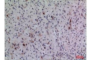 Immunohistochemistry (IHC) analysis of paraffin-embedded Human Brain, antibody was diluted at 1:100. (FGF5 抗体  (C-Term))