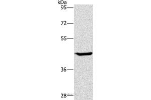 Western blot analysis of HT-29 cell, using GCK Polyclonal Antibody at dilution of 1:450 (GCK 抗体)