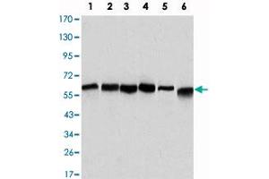 Western blot analysis using BECN1 monoclonal antibody, clone 2A4  against HeLa (1), A-431 (2), MCF-7 (3), Raji (4), Jurkat (5) and SK-BR-3 (6) cell lysate. (Beclin 1 抗体)