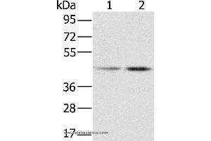 Western blot analysis of Hela and K562 cell, using RBMX Polyclonal Antibody at dilution of 1:800 (RBMX 抗体)