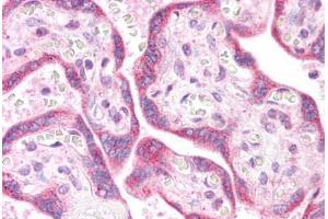 Human Placenta: Formalin-Fixed, Paraffin-Embedded (FFPE) (K-RAS 抗体  (N-Term))
