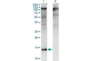 Western Blot analysis of ZBTB16 expression in transfected 293T cell line by ZBTB16 monoclonal antibody (M01), clone 3A7. (ZBTB16 抗体  (AA 381-480))