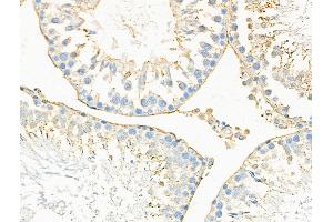 ABIN6257384 and ABIN6275302 at 1/100 staining Rat testis tissue by IHC-P. (Neurocan 抗体  (Internal Region))