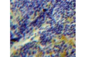 Used in DAB staining on fromalin fixed paraffin-embedded Spleen tissue