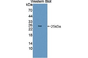 Detection of Recombinant FGF12, Human using Polyclonal Antibody to Fibroblast Growth Factor 12 (FGF12) (FGF12 抗体  (AA 1-181))