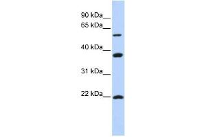 MYLIP antibody used at 1 ug/ml to detect target protein. (MYLIP 抗体  (Middle Region))