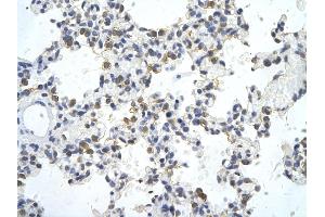 Rabbit Anti-ZNF444 antibody        Paraffin Embedded Tissue:  Human Lung cell   Cellular Data:  Epithelial cells of renal tubule  Antibody Concentration:   4. (ZNF444 抗体  (C-Term))