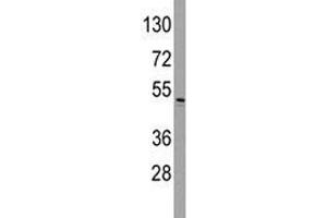 Western blot analysis of ILK antibody and HeLa lysate. (ILK 抗体  (AA 225-253))