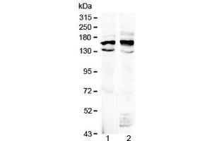 Western blot testing of 1) rat brain and 2) mouse brain lysate with Formin antibody at 0. (FMN1 抗体  (AA 1195-1419))