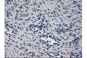 Immunohistochemical staining of paraffin-embedded liver tissue using anti-CYP2E1 mouse monoclonal antibody. (CYP2E1 抗体)