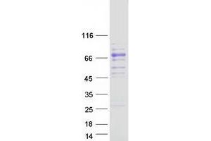 Validation with Western Blot (Coagulation Factor X Protein (F10) (Myc-DYKDDDDK Tag))