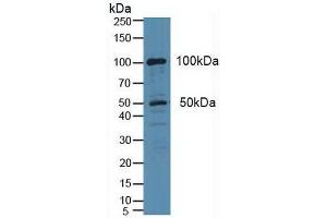 Western blot analysis of Human HeLa cells. (PLA2G4A 抗体  (AA 1-178))