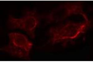 ABIN6272305 staining LOVO cells by IF/ICC. (GANAB 抗体  (Internal Region))
