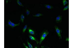 Immunofluorescent analysis of Hela cells using ABIN7169998 at dilution of 1:100 and Alexa Fluor 488-congugated AffiniPure Goat Anti-Rabbit IgG(H+L) (SLC17A3 抗体  (AA 1-125))