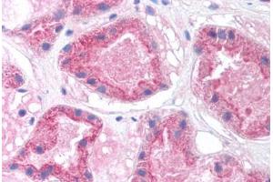 Human Kidney (formalin-fixed, paraffin-embedded) stained with HNF4A antibody ABIN214775 at 5 ug/ml followed by biotinylated goat anti-rabbit IgG secondary antibody ABIN481713, alkaline phosphatase-streptavidin and chromogen. (HNF4A 抗体  (N-Term))