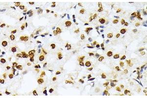 Immunohistochemistry of paraffin-embedded Human stomach using TriMethyl-Histone H3-K27 Polyclonal Antibody at dilution of 1:100 (40x lens).