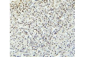 IHC analysis of PTBP2 using anti-PTBP2 antibody (ABIN7599452). (PTBP2 抗体  (AA 1-504))