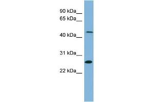 WB Suggested Anti-UPB1 Antibody Titration:  0. (UPB1 抗体  (Middle Region))
