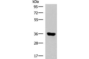 Western blot analysis of Human muscle tissue lysate using KCNK15 Polyclonal Antibody at dilution of 1:1000 (KCNK15 抗体)