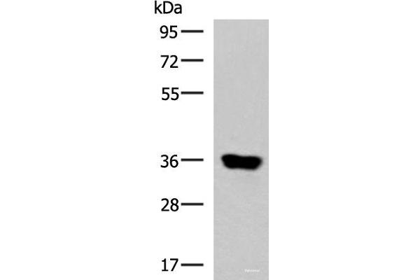 KCNK15 Antikörper