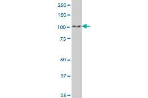 SALL4 monoclonal antibody (M03), clone 6E3 Western Blot analysis of SALL4 expression in Hela S3 NE . (SALL4 抗体  (AA 954-1053))